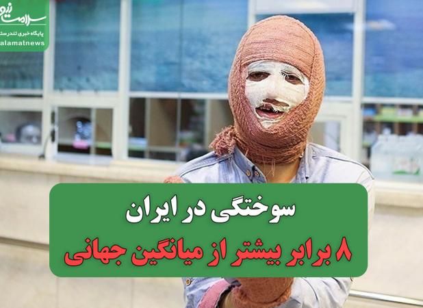 سوختگی در ایران، ۸ برابر بیشتر از میانگین جهانی