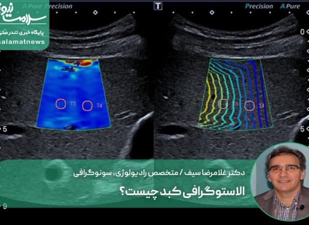 الاستوگرافی کبد چیست؟