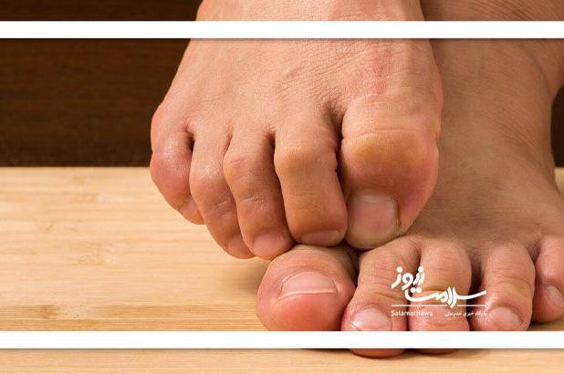 بی‌حسی پاها از زانو به پایین؛ زنگ خطری برای سلامت عصبی و عروقی