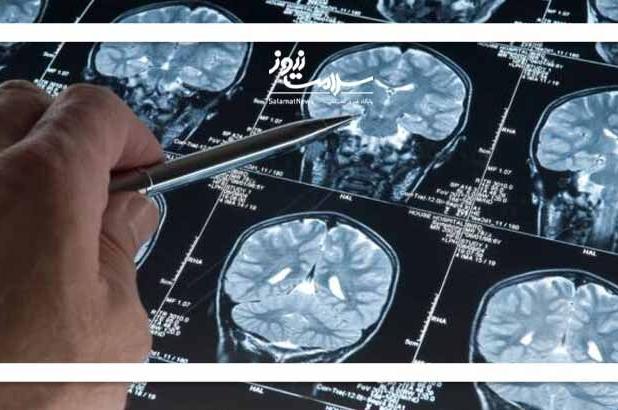 نشانه‌هایی که خبر از سرطان مغز می‌دهند