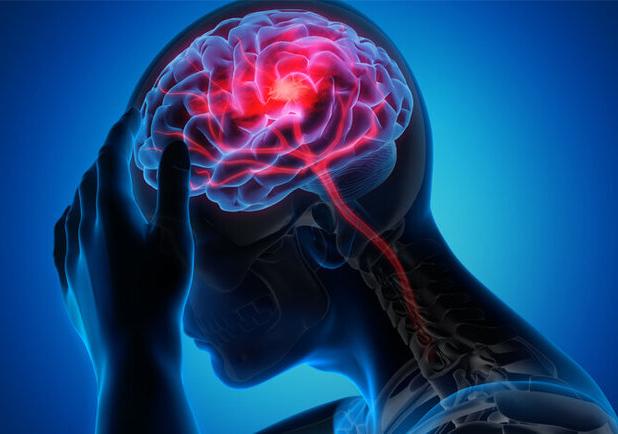 خیران: هر دقیقه در سکته مغزی حیاتی است