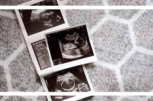 مراقبت های سه ماهه دوم بارداری؛ توصیه‌های کلیدی متخصصان برای سلامت مادر و جنین