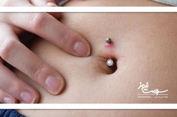 عفونت ناف می‌تواند خطرناک یا حتی مرگبار باشد