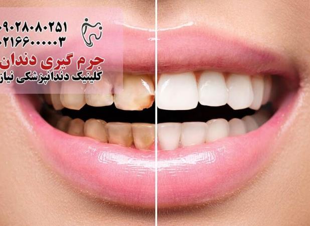 مراقبت‌های دندانپزشکی که باید قبل از ۴۰ سالگی انجام دهید