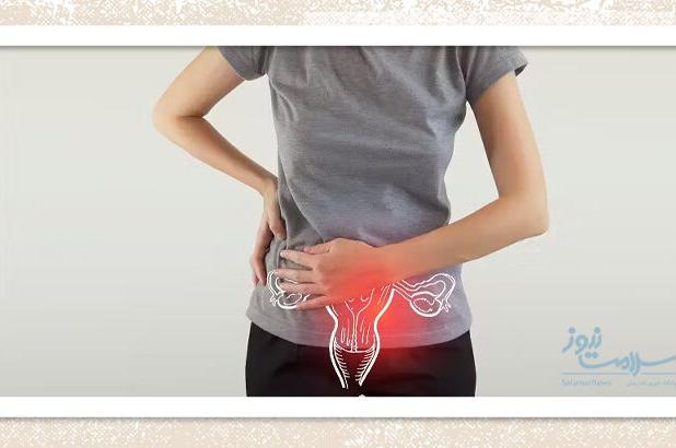 شناسایی مولکول F2R؛ امیدی تازه برای درمان سرطان تخمدان