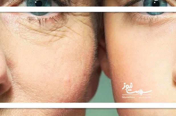 چرا برخی پیرتر از سن واقعی خود نشان می‌دهند؟