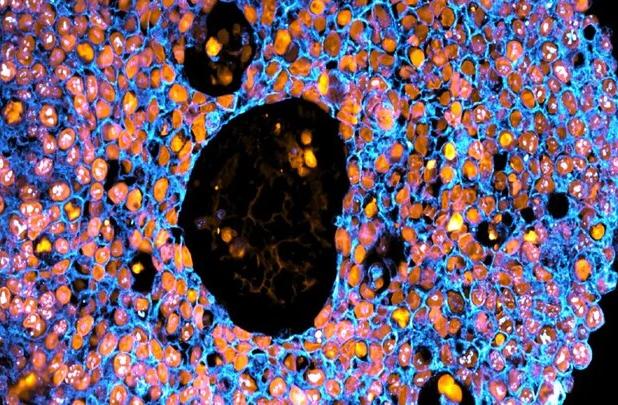 بررسی چالش‌های بارداری با کمک چاپ سه بعدی 