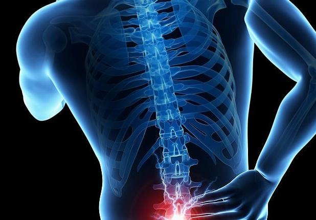 آیا سیاتیک درمان دارد؟ از کنترل درد تا بهبودی کامل