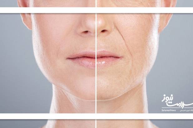 وقتی سرما پوست را می‌خشکد