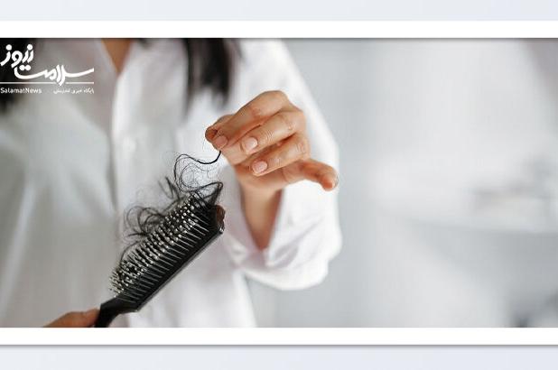 چرا با سرد شدن هوا بیشتر از همیشه ریزش مو دارید؟