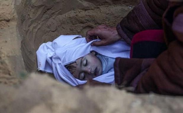 افزایش تأمل‌برانگیز تولد نوزادان نارس در غزه