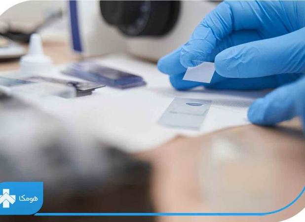 تست اچ پی وی چگونه انجام میشود؟ نکات مهم انجام آزمایش