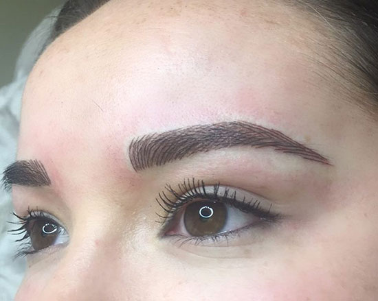 پاک کردن تاتو با چه روش‌هایی قابل انجام است؟