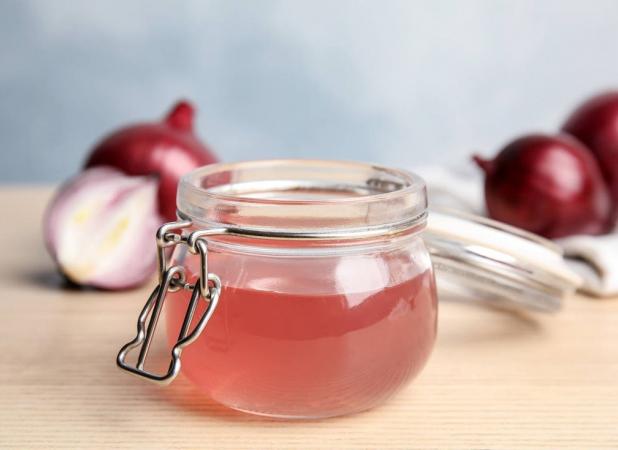 چطور با آب پیاز موهای سالم تری داشته باشیم؟