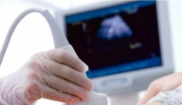 سونوگرافی در منزل: راحتی و دقت در کنار هم با تیم نبض اول