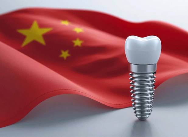 ایمپلنت دندان چینی: خطرناک یا اقتصادی؟ (بررسی برندهای چینی)