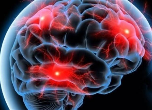 دستاورد هسته‌ای ایران؛ رادیوداروی ایرانی آلزایمر را ۲۰ سال زودتر شناسایی می‌کند