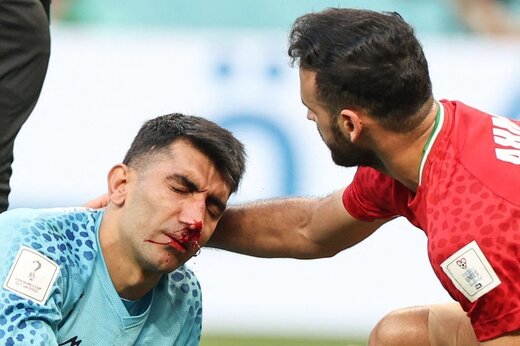 خبر بد برای تیم کی‌روش در آستانه بازی با ولز