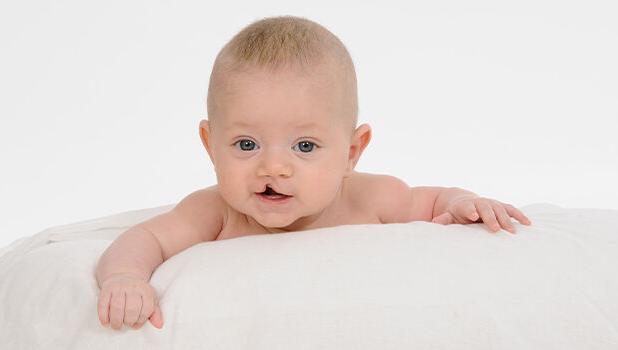 ۵۶ اختلال مادرزادی تحت پوشش موسسه محکم/ درخواست برای افزایش همکاری خیرین
