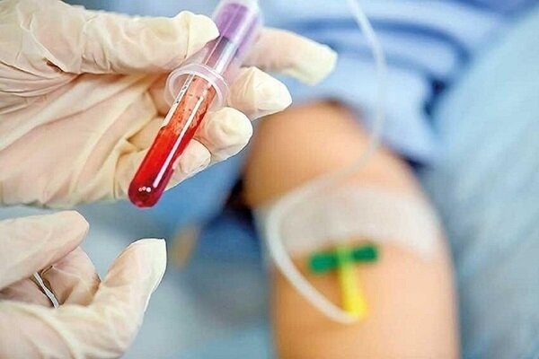۷۰ درصد کیسه های خون فیلتردار شده اند