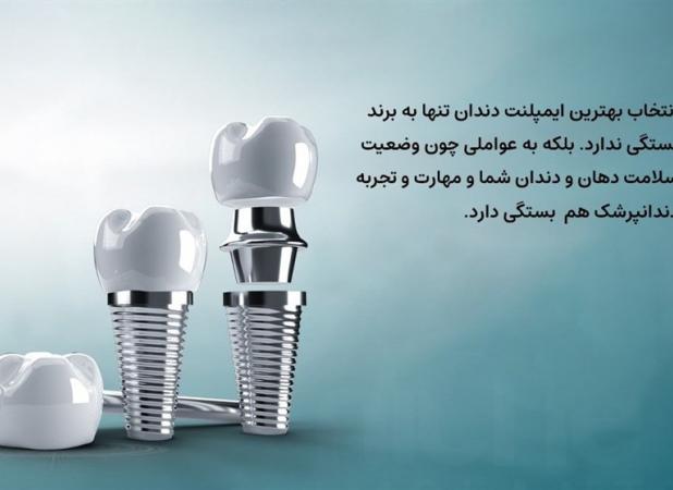 بهترین برندهای ایمپلنت دندان در ایران از نگاه متخصصان