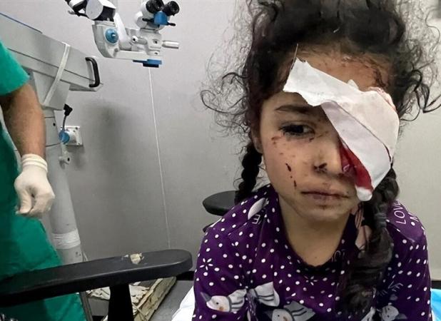 ۱۵۰۰ فلسطینی بینایی خود را در جنگ غزه از دست داده‌اند