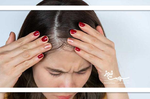 چطور ریزش مو را کنترل کنیم؟