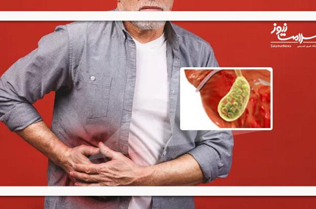 چگونه بفهمم که سنگ کیسه صفرا دارم؟