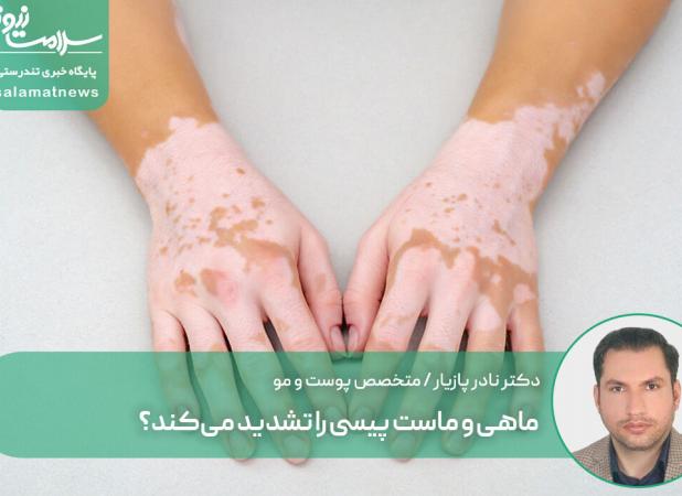 ماهی و ماست پیسی را تشدید می‌کند؟