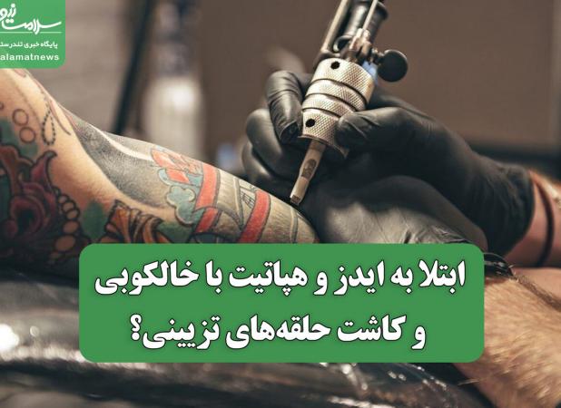 ابتلا به ایدز و هپاتیت با خالکوبی و کاشت حلقه‌های تزیینی؟