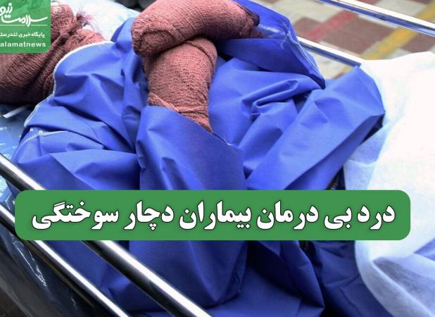 درد بی درمان بیماران دچار سوختگی