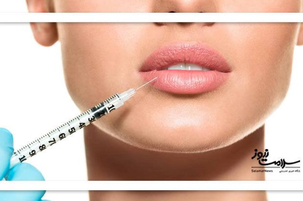 علائم خطرناک بعد از تزریق ژل و فیلر را جدی بگیرید!