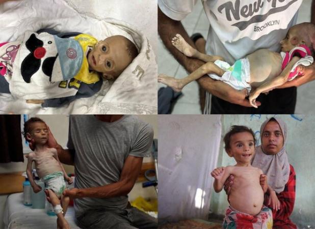 شهادت یک نوزاد فلسطینی و مرگ تدریجی نوزادی دیگر در غزه+ تصاویر