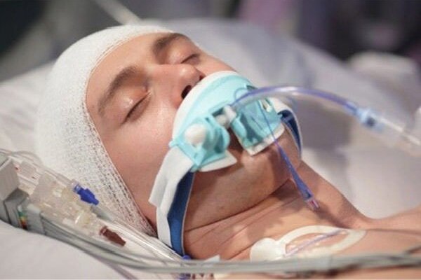 تهدید خاموش سرمایه انسانی؛ ضربه مغزی زندگی را متوقف می‌کند