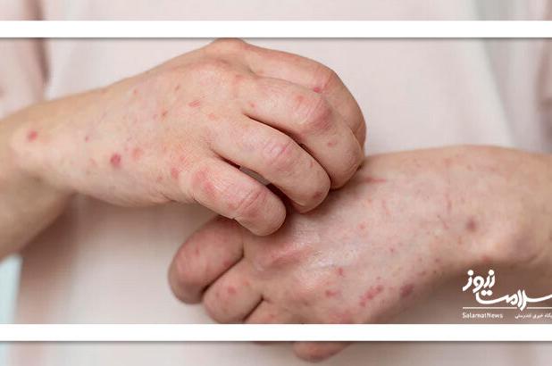 نشانه های کمتر شناخته شده یک روده ناسالم