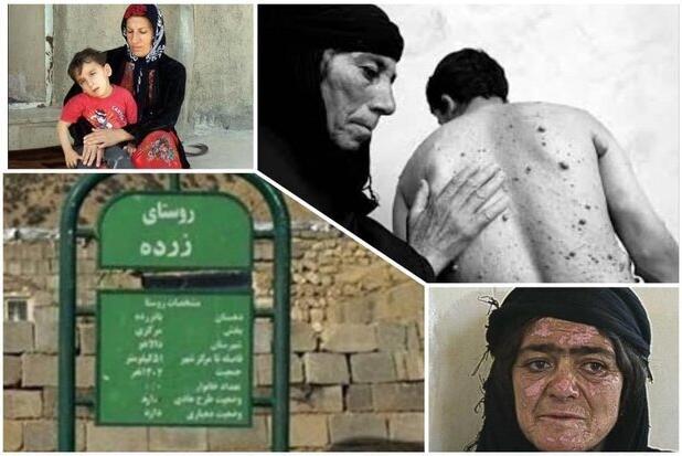 هیروشیمای ایران هنوز می‌سوزد؛ زرده، بایگانیِ دردهای خاموش