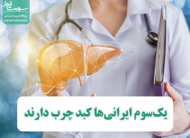 یک‌سوم ایرانی‌ها کبد چرب دارند