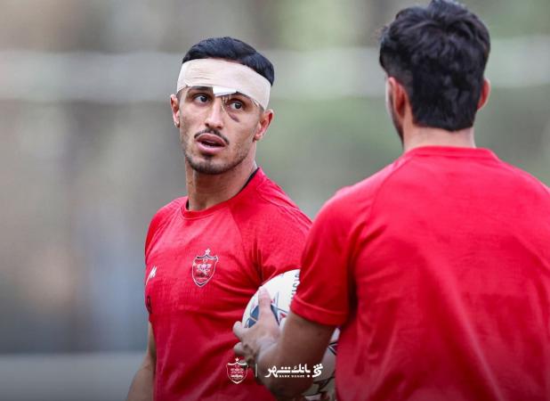 علیپور: ترسیدم بینایی‌ام را از دست بدهم