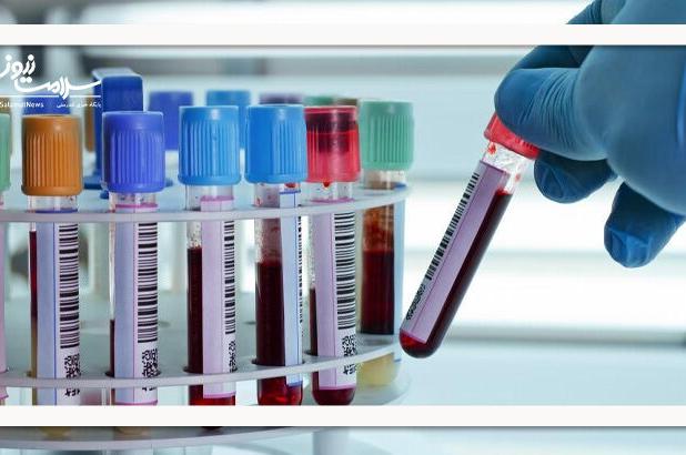 اولین آزمایش خون برای تشخیص آلزایمر تایید شد