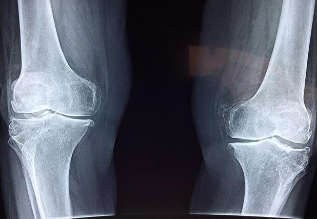 یک متخصص رادیولوژی: انجام بی‌مورد تصویربرداری‌های پزشکی سلامت جامعه را تهدید می‌کند