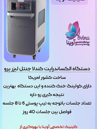 بهترین کلینیک لیزر موهای زائد در شمال تهران + معرفی ۱۰ مرکز برتر