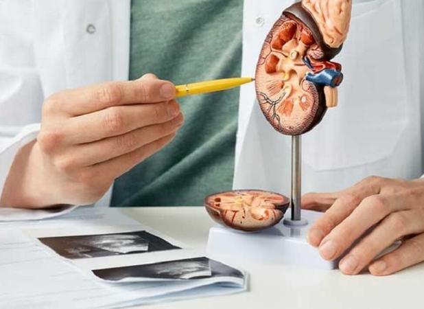 آیا دیابت باعث تشکیل سنگ کلیه می‌شود؟ ارتباط خطرناک قند خون بالا و سنگ کلیه