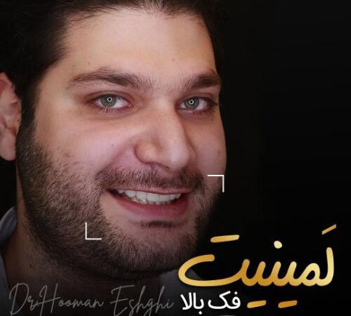 لمینت دندان برای چه کسانی مناسب است؟