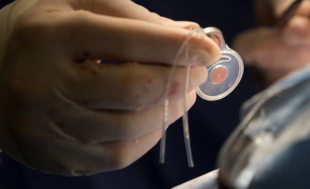 آغاز عملیات صید حلزون‌های ناقل شیستوزومیازیس در غرب اهواز