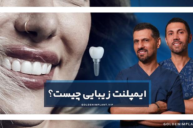ایمپلنت زیبایی چیست و چه تفاوتی با ایمپلنت معمولی دارد؟