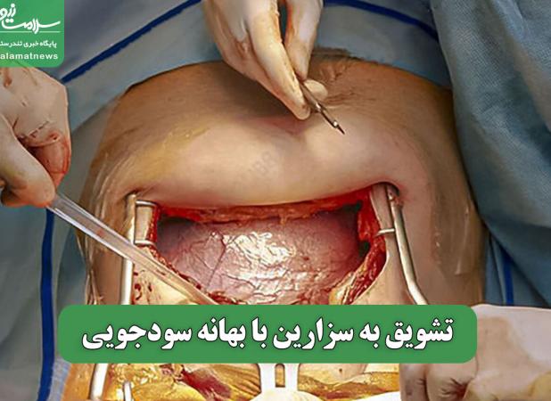 تشویق به سزارین با بهانه سودجویی
