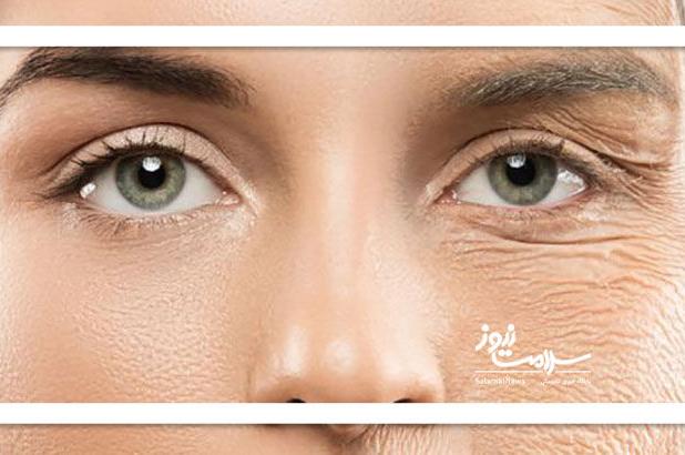 پشت مخفی کاری سن واقعی چیست؟