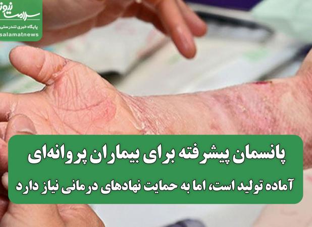 پانسمان پیشرفته برای بیماران پروانه‌ای آماده تولید است، اما به حمایت نهادهای درمانی نیاز دارد