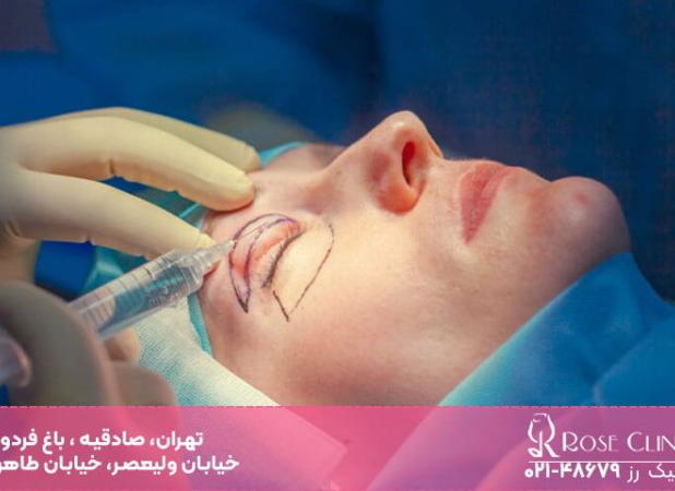 آیا عمل بلفاروپلاستی خطرناک است​؟
