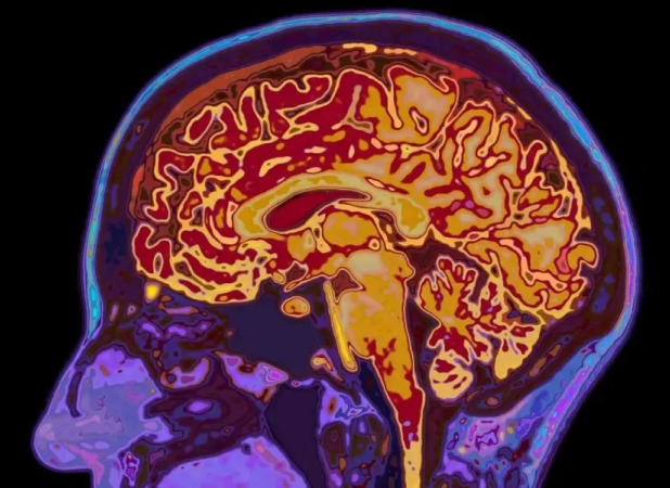 شوک علمی: مغز انسان تا ۳۲ سالگی کامل نمی‌شود